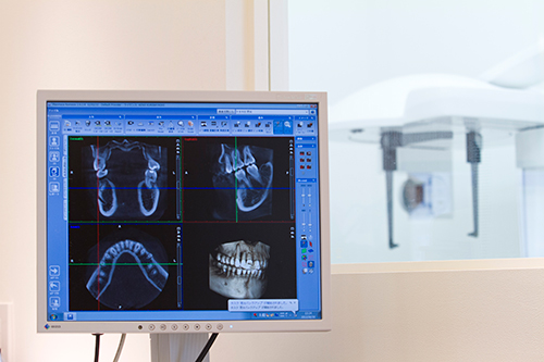 歯科用CTによる精密な診査診断