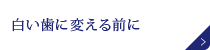 白い歯に変える前に