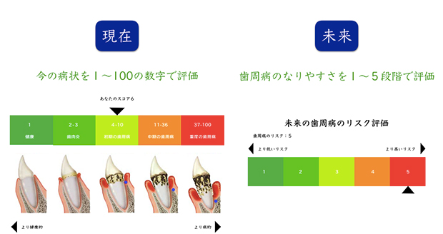 検査⑤【OHIS】