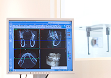 2.	歯科用CTを使用して検査します