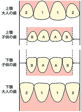混合歯列期-2