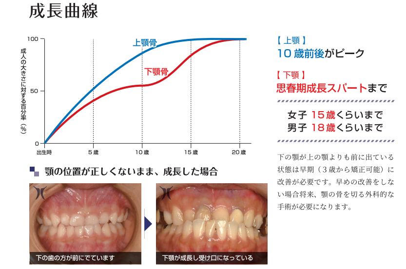 成長曲線