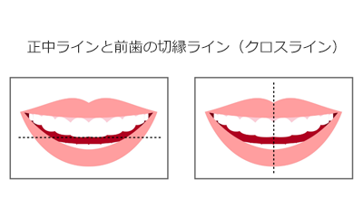 DSDのソフトについて