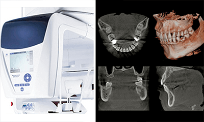  歯科用CTとは