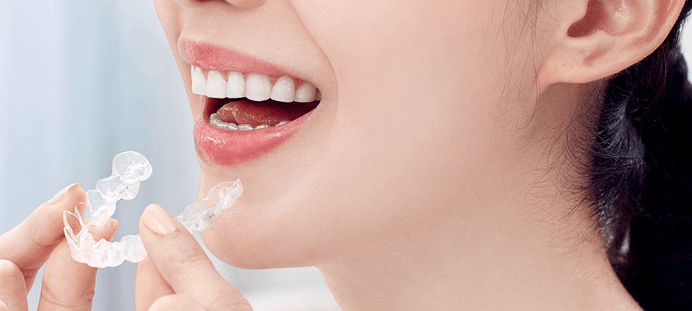 歯並び、咬み合わせを整え予防するマウスピース型矯正治療