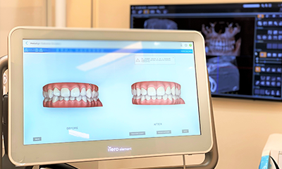 特徴3　最新機器を使用したお子さんにも安心な矯正治療