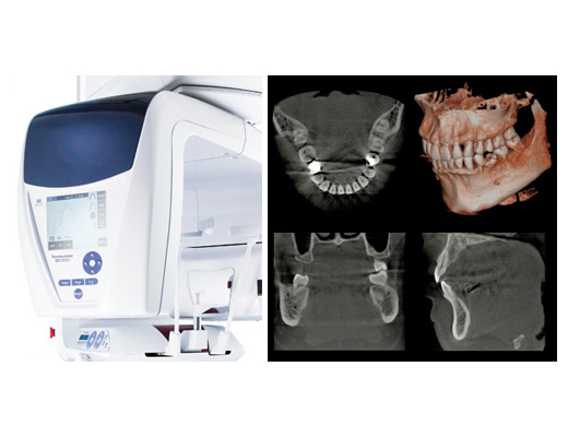 歯科用CT